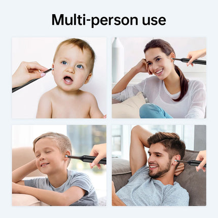 Smart Visual Ear Cleaner Ear Sticks Otoscope Type-C Charging Endoscope Wax Removal Tool Earpick MIni Camera Health Care Set
