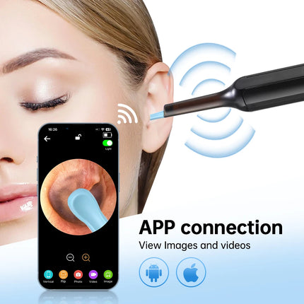 Smart Visual Ear Cleaner Ear Sticks Otoscope Type-C Charging Endoscope Wax Removal Tool Earpick MIni Camera Health Care Set